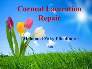 Corneal Laceration
Repair
· Mohamed Zaky Elkadim MD
· 2020
 
