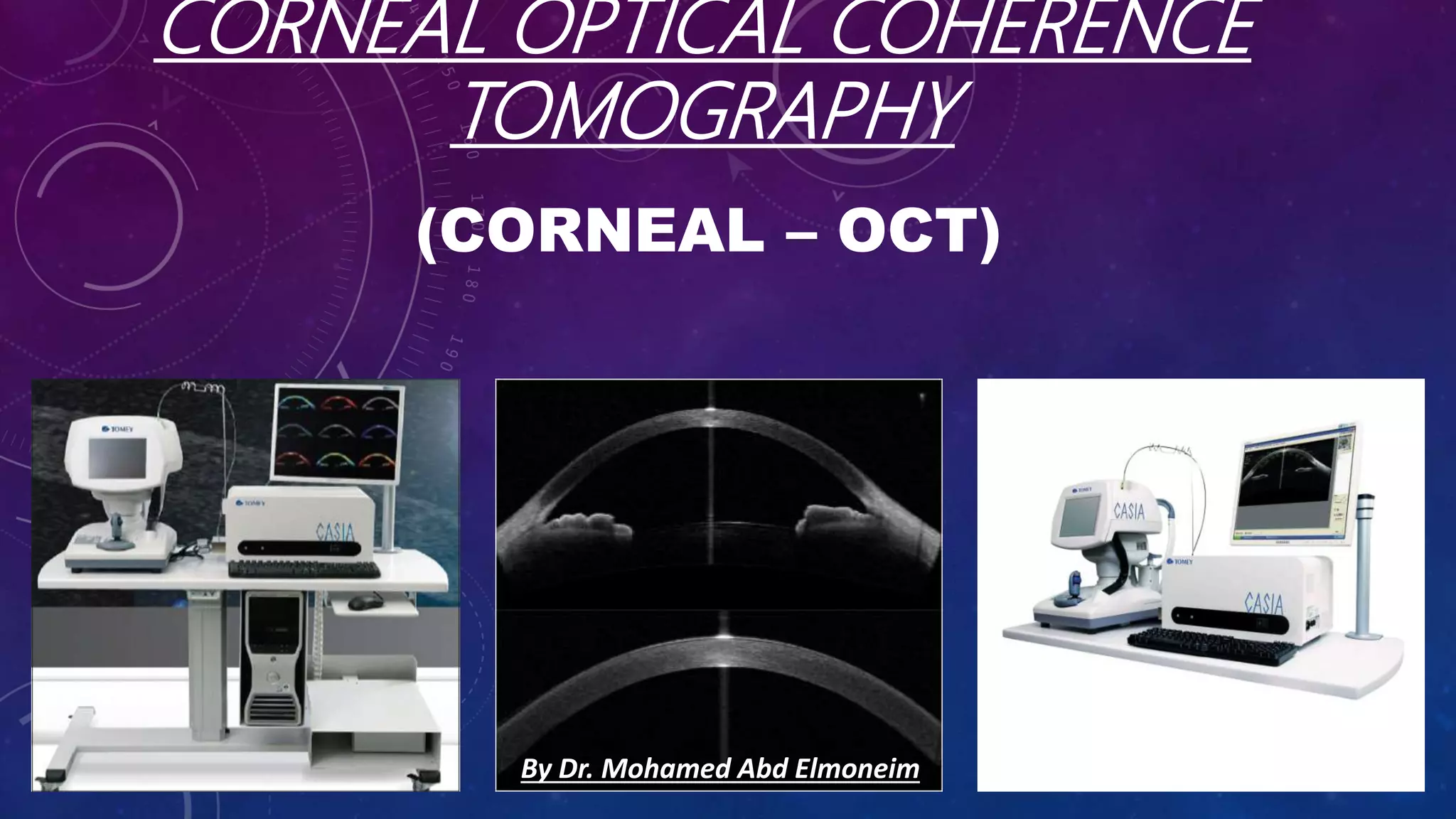 Anterior segment and Corneal OCT review | PPSX