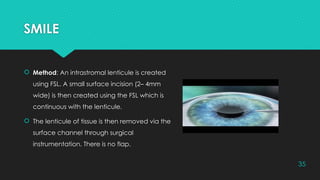 Fsl Instrumentation COMPARE AND CONTRAST: CORNEAL REFRACTIVE SURGERIES.pptx