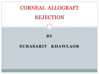 CORNEAL ALLOGRAFT
     REJECTION


        BY

SURASARIT   KHAWLAOR
 