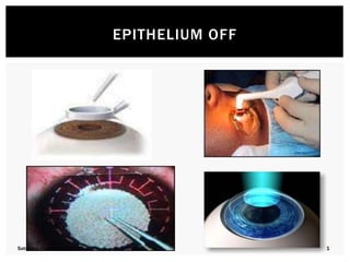 Corneal Topography Corneal Cross Linking Pediatric and Presbyopic ...