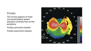 Protate Pattern 4 Corneal topographic patterns.pptx