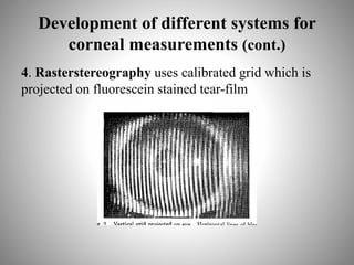 Development of different systems for
corneal measurements (cont.)
4. Rasterstereography uses calibrated grid which is
projected on fluorescein stained tear-film
 