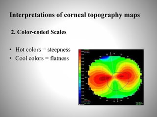 Interpretations of corneal topography maps
2. Color-coded Scales
• Hot colors = steepness
• Cool colors = flatness
 