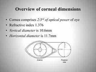 Overview of corneal dimensions
• Cornea comprises 2/3rd of optical power of eye
• Refractive index 1.376
• Vertical diameter is 10.6mm
• Horizontal diameter is 11.7mm
 