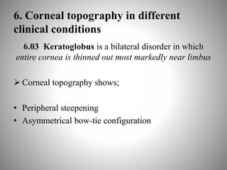 6. Corneal topography in different
clinical conditions
6.03 Keratoglobus is a bilateral disorder in which
entire cornea is thinned out most markedly near limbus
 Corneal topography shows;
• Peripheral steepening
• Asymmetrical bow-tie configuration
 
