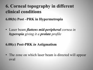 6. Corneal topography in different
clinical conditions
6.08(b) Post –PRK in Hypermetropia
• Laser beam flattens mid-peripheral cornea in
hyperopia giving it a prolate profile
6.08(c) Post-PRK in Astigmatism
• The zone on which laser beam is directed will appear
oval
 