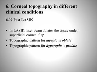 6. Corneal topography in different
clinical conditions
6.09 Post LASIK
• In LASIK laser beam ablates the tissue under
superficial corneal flap
• Topographic pattern for myopia is oblate
• Topographic pattern for hyperopia is prolate
 