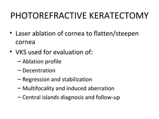 PHOTOREFRACTIVE KERATECTOMY
• Laser ablation of cornea to flatten/steepen
cornea
• VKS used for evaluation of:
– Ablation profile
– Decentration
– Regression and stabilization
– Multifocality and induced aberration
– Central islands diagnosis and follow-up
 