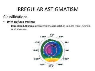 IRREGULAR ASTIGMATISM
Classification:
• With Defined Pattern
– Decentered Ablation: decentered myopic ablation in more than 1.5mm in
central cornea
 