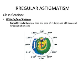 IRREGULAR ASTIGMATISM
Classification:
• With Defined Pattern
– Central Irregularity: more than one area of <1.0mm and <1D in central
myopic ablation zone
 