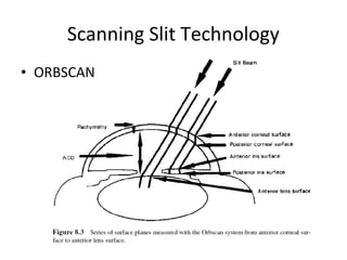 Scanning Slit Technology
• ORBSCAN
 