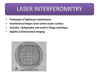 • Technique of lightwave interference
• Interference fringes cover entire ocular surface
• Includes : holography and moire’s fringe tachnique
• Applies 3-dimensional imaging
 