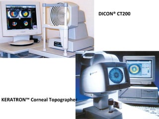 DICON® CT200
KERATRON™ Corneal Topographer
 