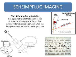 The Scheimpflug principle:
It is a geometric rule that describes the
orientation of the plane of focus of an
optical system (such as a camera) when the
lens plane is not parallel to the image plane
 