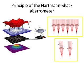 Principle of the Hartmann-Shack
aberrometer
 