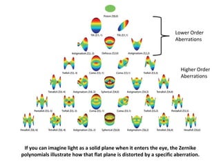 If you can imagine light as a solid plane when it enters the eye, the Zernike
polynomials illustrate how that flat plane is distorted by a specific aberration.
Lower Order
Aberrations
Higher Order
Aberrations
 