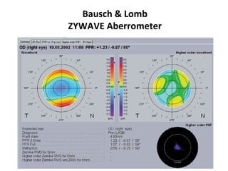 Bausch & Lomb
ZYWAVE Aberrometer
 