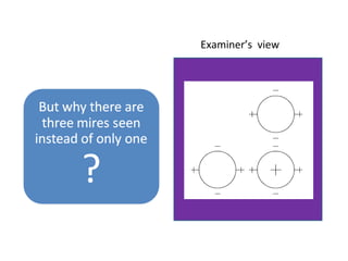 Examiner’s view
 