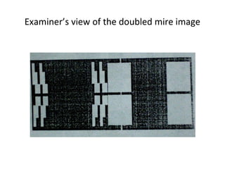 Examiner’s view of the doubled mire image
 