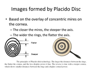 Images formed by Placido Disc
• Based on the overlay of concentric mires on
the cornea.
– The closer the mires, the steeper the axis.
– The wider the rings, the flatter the axis.
 