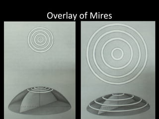 Overlay of Mires
 