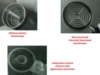 Maloney Conical
Keratoscope Klein Hand-held
internally illuminated
Keratoscope
Astigmatism control
enforcer with
Applanation tonometer
 