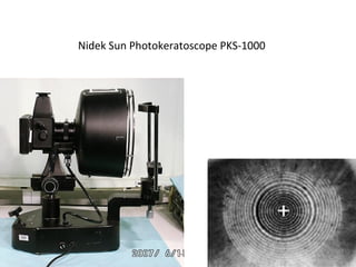 Nidek Sun Photokeratoscope PKS-1000
 