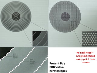 Present Day
PDB Video-
Keratoscopes
The Real Need –
Analysing each &
every point over
cornea
 