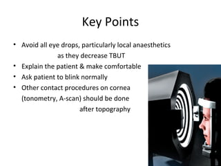 Key Points
• Avoid all eye drops, particularly local anaesthetics
as they decrease TBUT
• Explain the patient & make comfortable
• Ask patient to blink normally
• Other contact procedures on cornea
(tonometry, A-scan) should be done
after topography
 