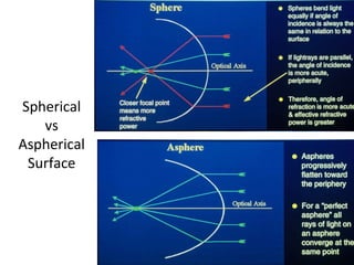Spherical
vs
Aspherical
Surface
 