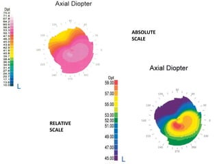 ABSOLUTE
SCALE
RELATIVE
SCALE
 
