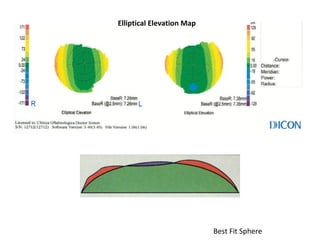 Elliptical Elevation Map
Best Fit Sphere
 
