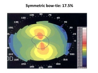 Symmetric bow-tie: 17.5%
 