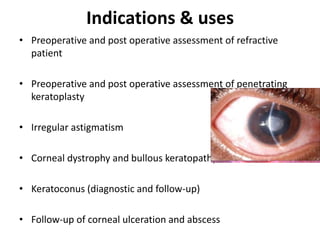 Indications & uses
• Preoperative and post operative assessment of refractive
patient
• Preoperative and post operative assessment of penetrating
keratoplasty
• Irregular astigmatism
• Corneal dystrophy and bullous keratopathy
• Keratoconus (diagnostic and follow-up)
• Follow-up of corneal ulceration and abscess
 