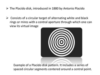  The Placido disk, introduced in 1880 by Antonio Placido
 Consists of a circular target of alternating white and black
rings or mires with a central aperture through which one can
view its virtual image
Example of a Placido disk pattern. It includes a series of
spaced circular segments centered around a central point.
 