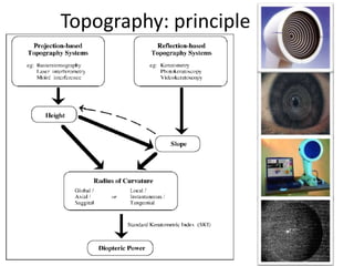 Topography: principle
 