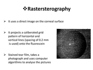 Rastersterography
 It uses a direct image on the corneal surface
 It projects a caliberated grid
pattern of horizontal and
vertical lines (spacing of 0.2 mm
is used) onto the fluorescein
 Stained tear film, takes a
photograph and uses computer
algorithms to analyse the pictures
 