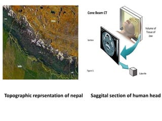 Topographic reprsentation of nepal Saggital section of human head
 
