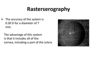 Rasterserography
 The accuracy of the system is
0.30 D for a diameter of 7
mm.
The advantage of this system
is that it includes all of the
cornea, including a part of the sclera.
 