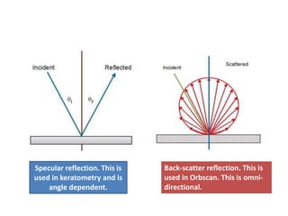 Back-scatter reflection. This is
used in Orbscan. This is omni-
directional.
Specular reflection. This is
used in keratometry and is
angle dependent.
 