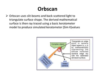 Orbscan
 Orbscan uses slit-beams and back-scattered light to
triangulate surface shape. The derived mathematical
surface is then ray traced using a basic keratometer
model to produce simulated keratometer (Sim K)values
 