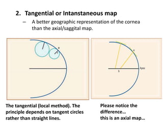 2. Tangential or Intanstaneous map
– A better geographic representation of the cornea
than the axial/saggital map.
The tangential (local method). The
principle depends on tangent circles
rather than straight lines.
Please notice the
difference…
this is an axial map…
 