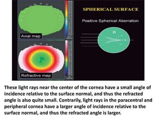 These light rays near the center of the cornea have a small angle of
incidence relative to the surface normal, and thus the refracted
angle is also quite small. Contrarily, light rays in the paracentral and
peripheral cornea have a larger angle of incidence relative to the
surface normal, and thus the refracted angle is larger.
 