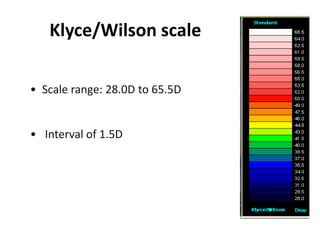 Klyce/Wilson scale
• Scale range: 28.0D to 65.5D
• Interval of 1.5D
 