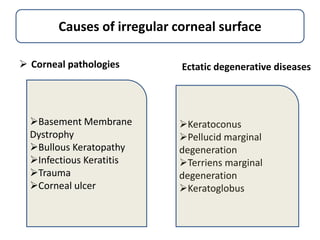 Causes of irregular corneal surface
 Corneal pathologies Ectatic degenerative diseases
Basement Membrane
Dystrophy
Bullous Keratopathy
Infectious Keratitis
Trauma
Corneal ulcer
Keratoconus
Pellucid marginal
degeneration
Terriens marginal
degeneration
Keratoglobus
 