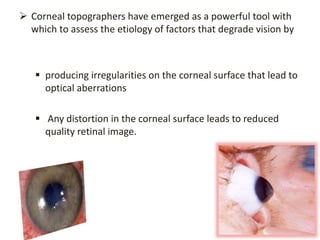 Corneal topographers have emerged as a powerful tool with
which to assess the etiology of factors that degrade vision by
 producing irregularities on the corneal surface that lead to
optical aberrations
 Any distortion in the corneal surface leads to reduced
quality retinal image.
 