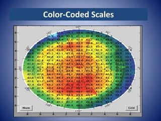 Corneal topography final | PPTX