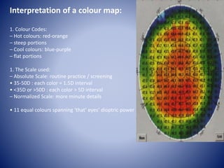 Corneal topography final | PPTX