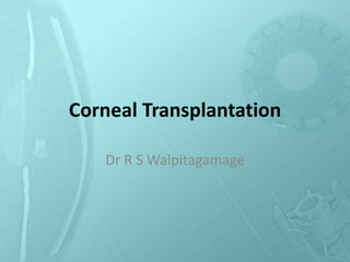 Corneal Transplantation
Dr R S Walpitagamage
 